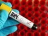 Саяногорцы могут пройти экспресс – тестирование на ВИЧ